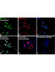 Antibodies