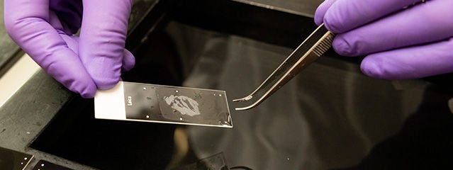 Immunhistokemi (IHC)
