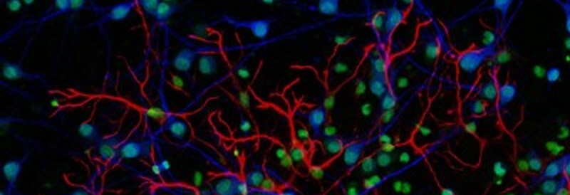 Technological Advancements in Fluorescence Microscopy 