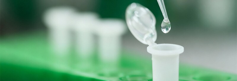 Optimize Your Immunoprecipitation (IP) with ChromoTek Nano-Traps