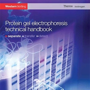 protein-gel-electrophoresis